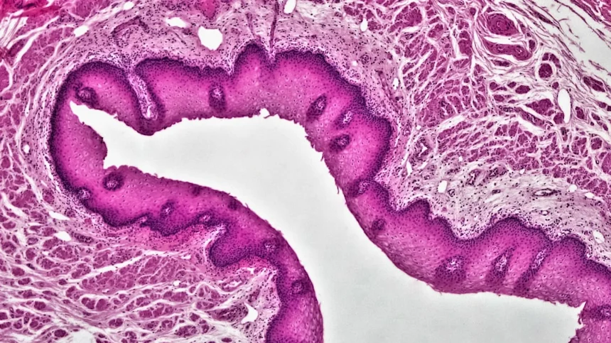 Colorectal 0