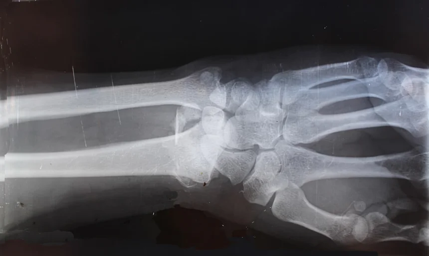 Orthopedic